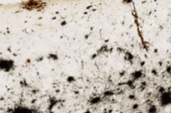 Mouse, Alzheimer Disease