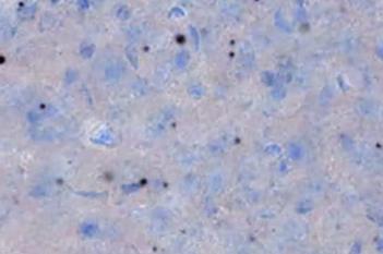 Mouse, Huntington's Disease