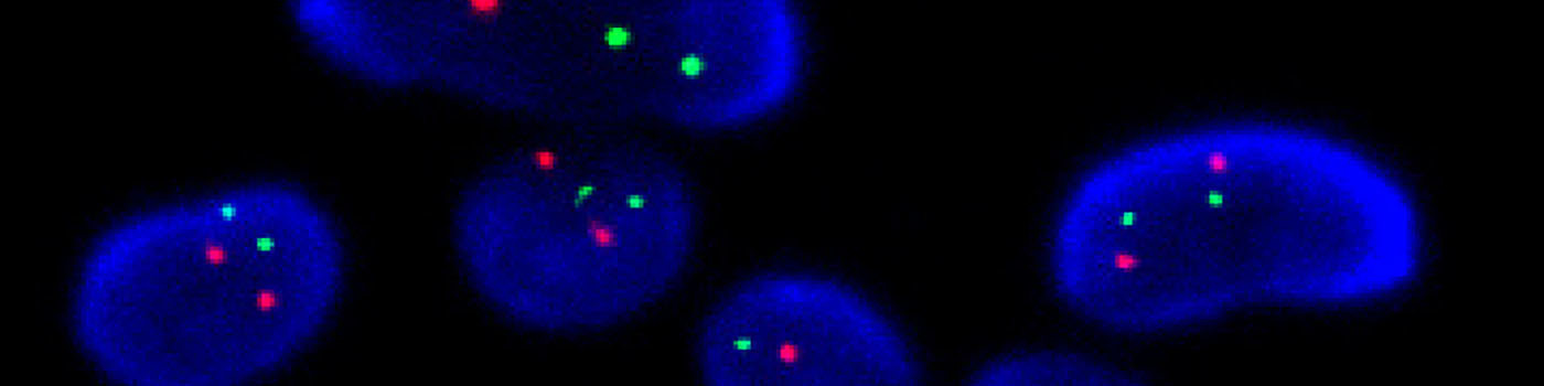 HER2-FISH, Breast Cancer