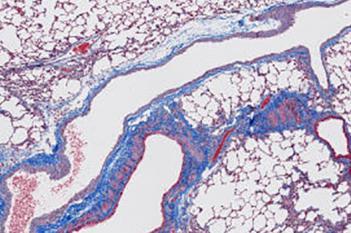 Rat, Pulmonary Fibrosis