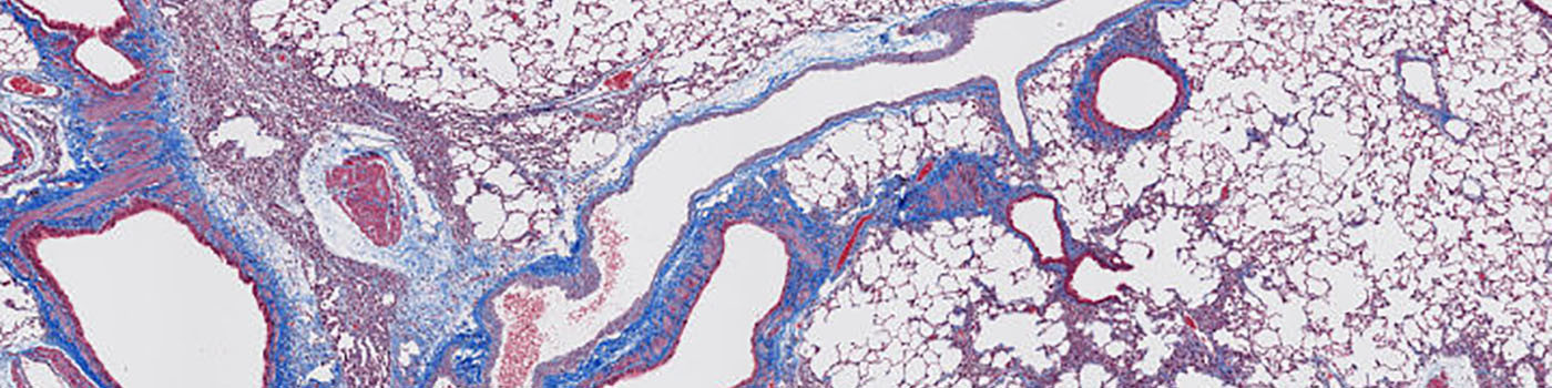 Rat, Pulmonary Fibrosis