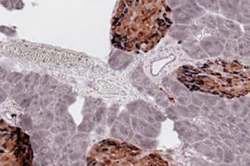 Mouse, Diabetes, Beta- & Non-beta Cell Area