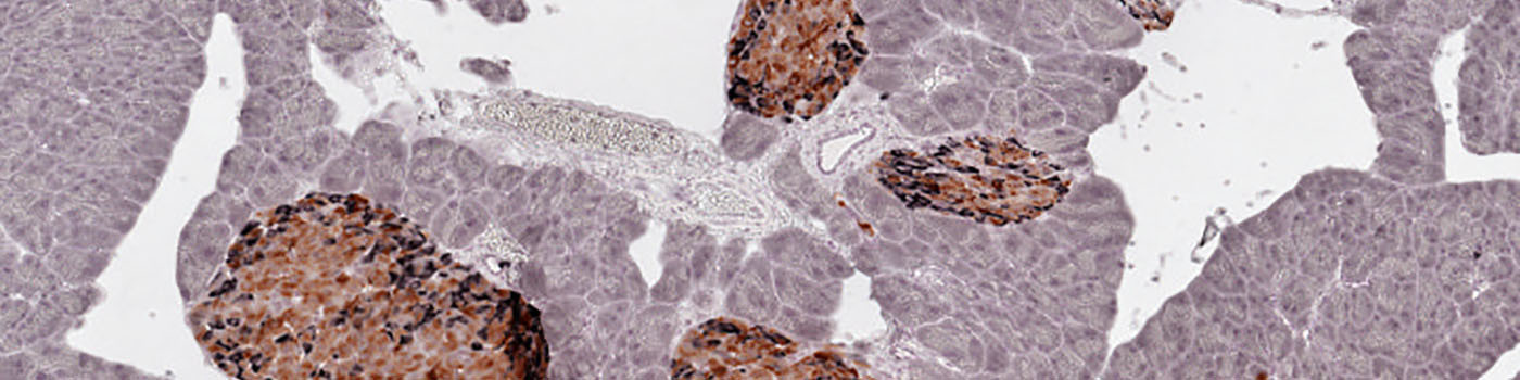 Mouse, Diabetes, Beta- & Non-beta Cell Area