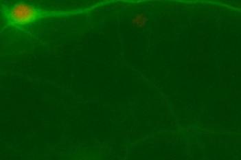 Rat, Cell Body Number and Neurite Length