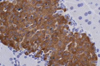 Mouse, Diabetes, Ki-67