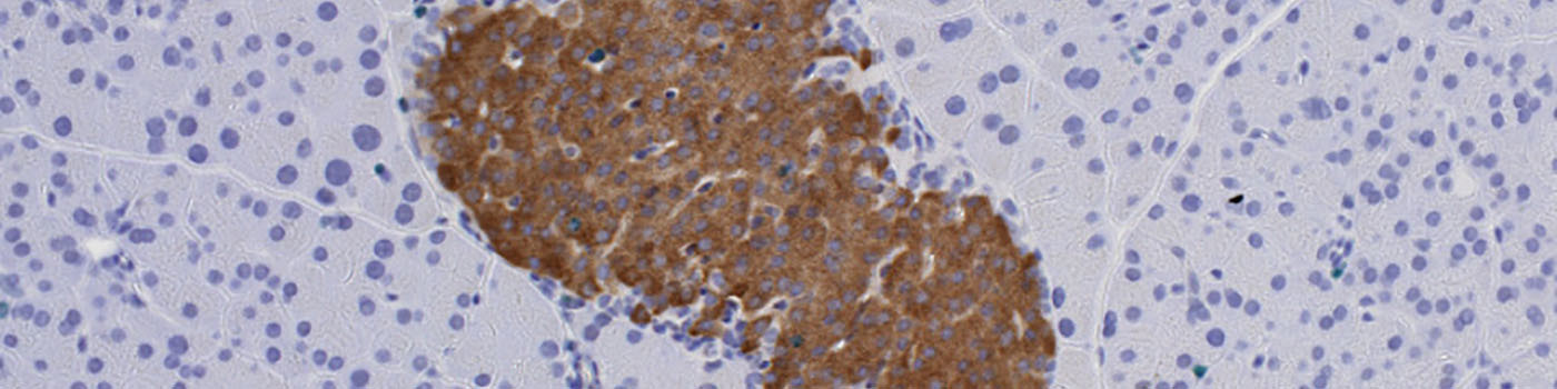 Mouse, Diabetes, Ki-67