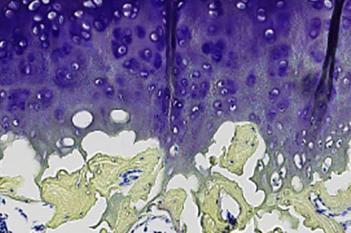 Guinea Pig, Joint Damage, Toluidine blue+Safron