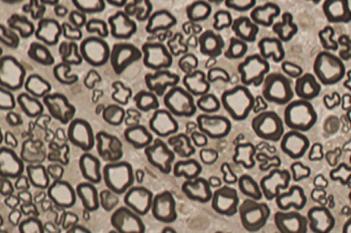 Rat, Neural Tissue Degeneration