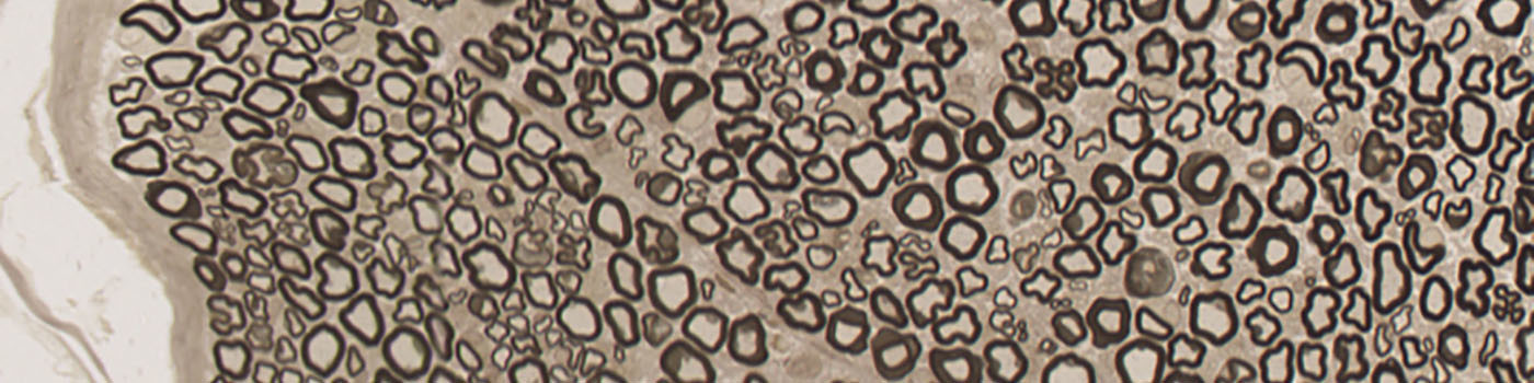 Rat, Neural Tissue Degeneration