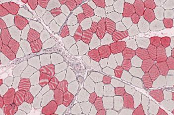 Mouse, Muscle Atrophy