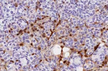 Mouse, Breast Cancer, Pos MRI Contrast Ratio