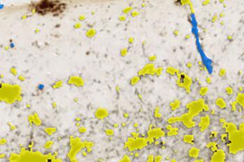 Mouse, Alzheimer Disease