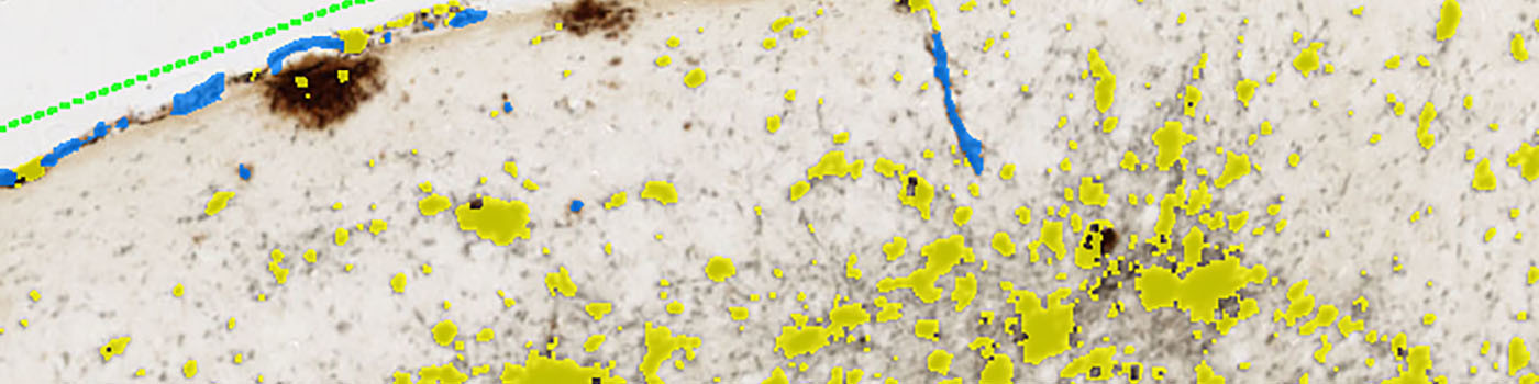 Mouse, Alzheimer Disease