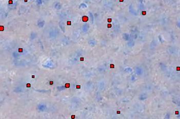 Mouse, Huntington's Disease