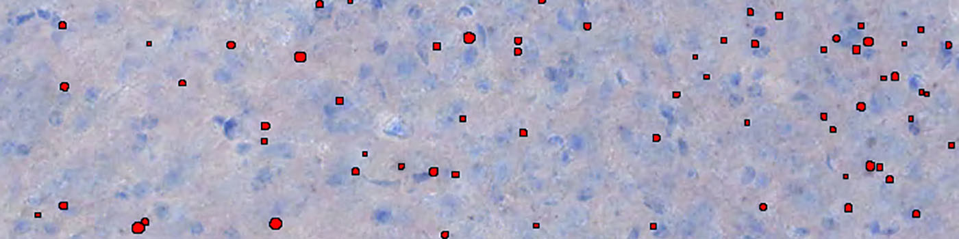 Mouse, Huntington’s Disease