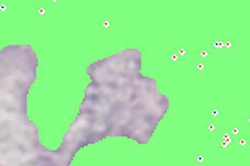 HER2-CISH, Breast Cancer