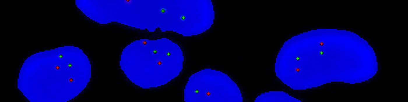 HER2-FISH, Breast Cancer