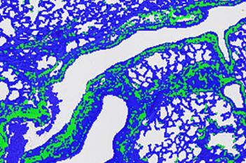 Rat, Pulmonary Fibrosis