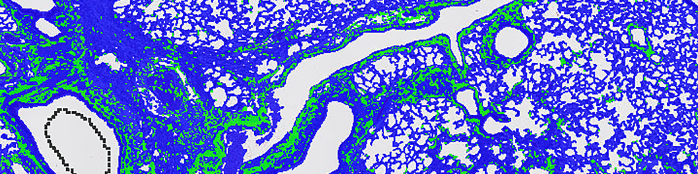 Rat, Pulmonary Fibrosis