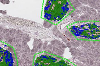 Mouse, Diabetes, Beta- & Non-beta Cell Area