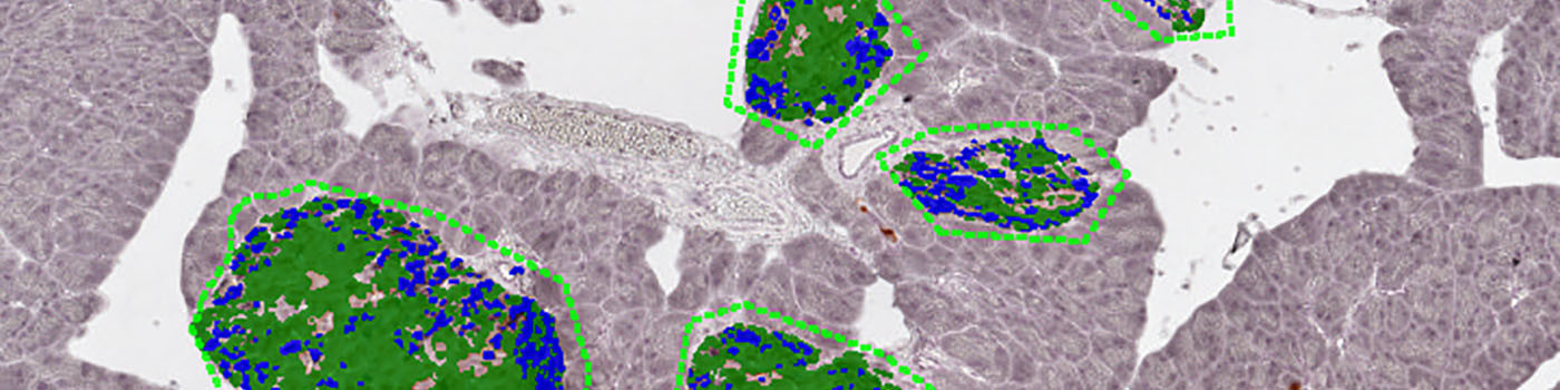 Mouse, Diabetes, Beta- & Non-beta Cell Area