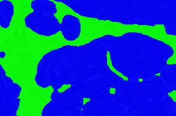 CK8/18, Breast Cancer