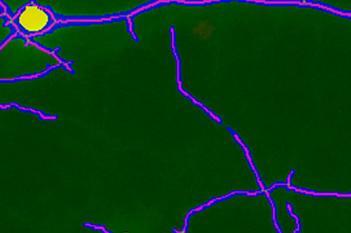 Rat, Cell Body Number and Neurite Length