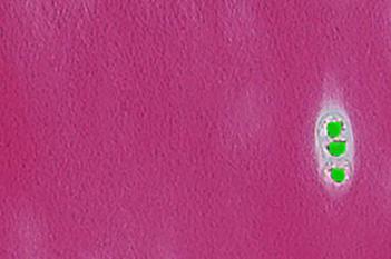 Bovine/Pig, Osteoarthritis