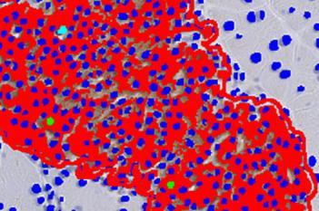 Mouse, Diabetes, Ki-67