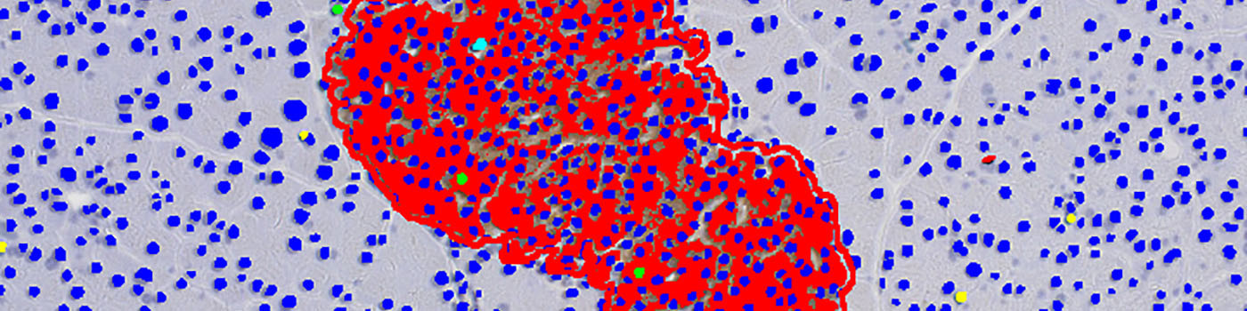 Mouse, Diabetes, Ki-67