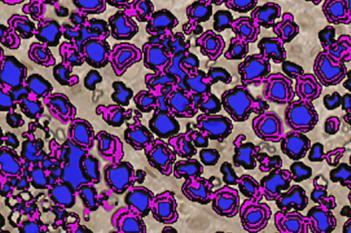 Rat, Neural Tissue Degeneration