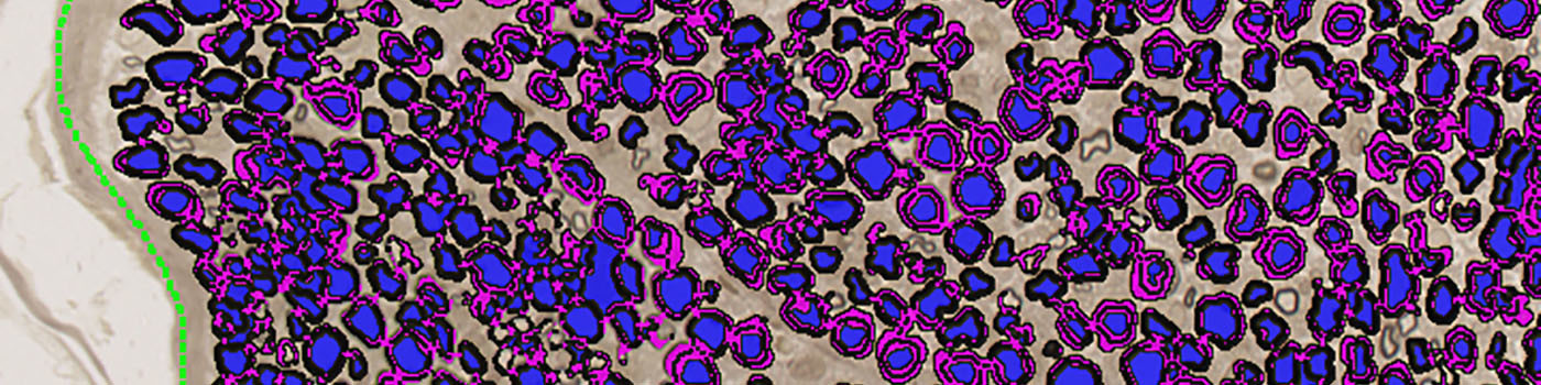 Rat, Neural Tissue Degeneration