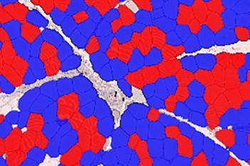 Mouse, Muscle Atrophy