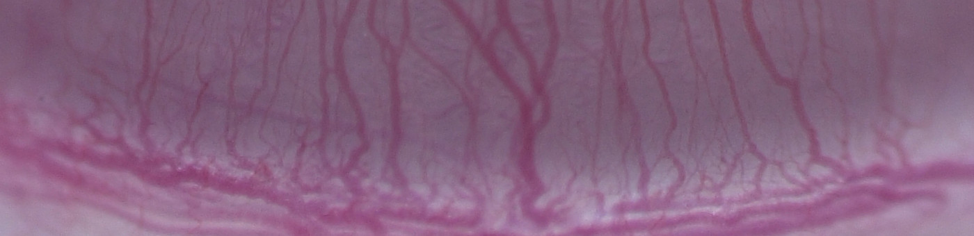 Rat, Corneal Neovascularization