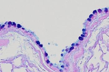 Rodent, Pulmonary MCM, AB-PAS