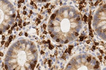 CD3, Lymphocytic Colitis