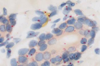 RNAscope, Skin Cancer