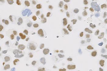 ER, Cell Lines, Cancer