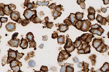 HER2, Cell Lines, Cancer