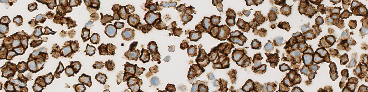 HER2, Cell Lines, Cancer