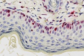 Ki-67, Epidermal Hyperplasia