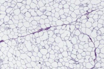 Iron Hematoxylin, Adipose Tissue