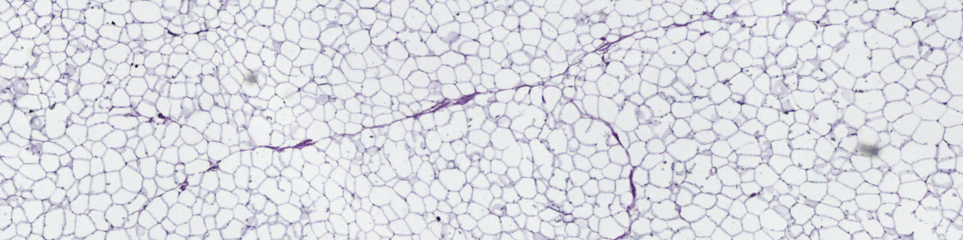 Iron Hematoxylin, Adipose Tissue