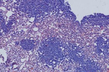 H&E, Lung Metastasis