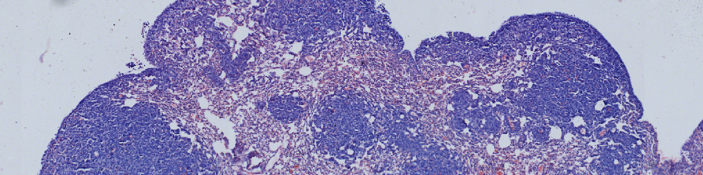H&E, Lung Metastasis