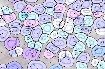 RNAscope, Hepatocellular Carcinoma