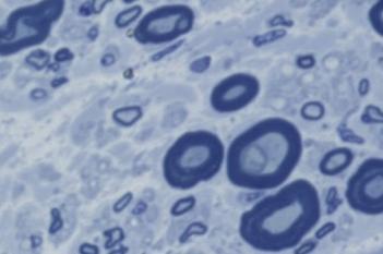 Toluidine Blue, Neuroscience