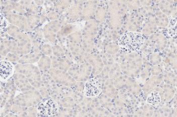 IHC, Glomeruli Detection, AI