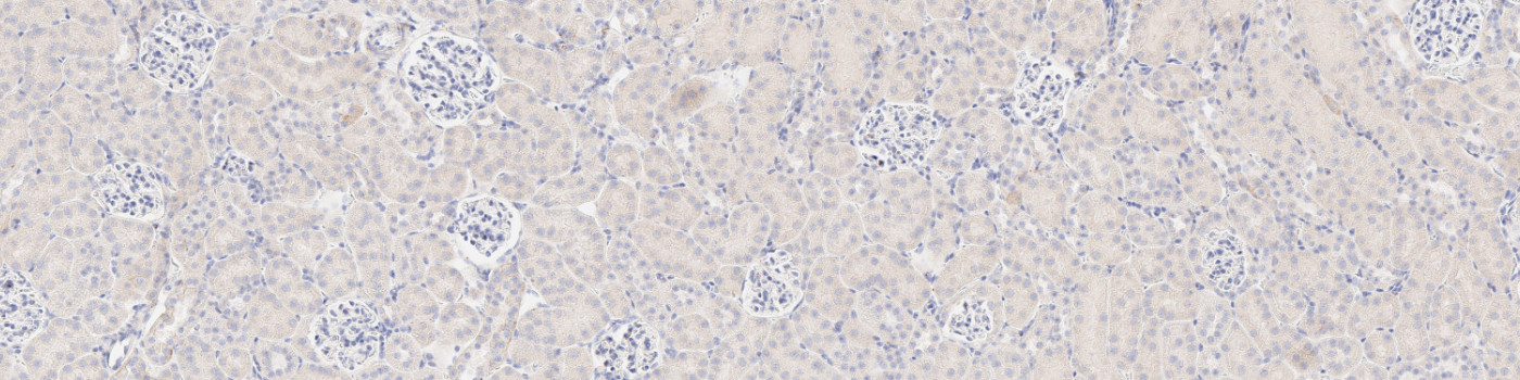 IHC, Glomeruli Detection, AI
