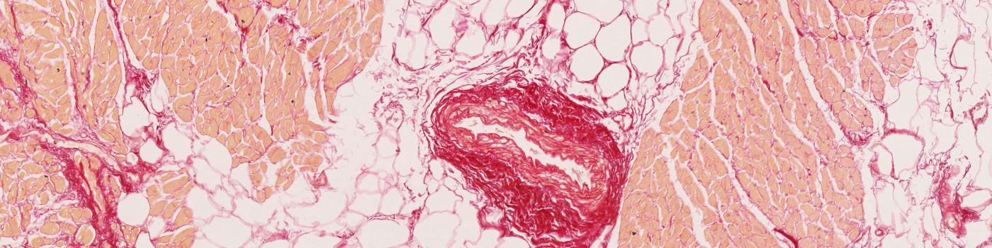 Picrosirius Red, SADS